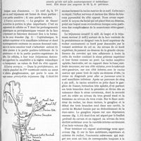 0566 - Page 879 - Partie scientifique. Le traitement chirurgical endocranien de la névralgie du trijumeau, par le Docteur J. Bourguet