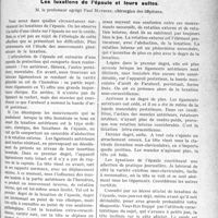 0800 - Page 1229 - Partie scientifique. Travaux Originaux. Le pneumothorax artificiel appartient au praticien, Dr André Jousset / Chirurgie. Les luxations de l’épaule et leurs suites, M. le professeur agrégé Paul Mathieu [Leçon faite à la Faculté de médecine de Paris et recueillie par le Dr P. Lacroix]