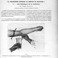 0016 - Page 15 - Partie scientifique. Travaux Originaux. La transfusion sanguine au service du praticien. Les techniques de la transfusion, par Georges Rosenthal