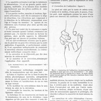 0820 - Page 801 - Partie scientifique. Travaux Originaux. Diététique infantile. Le redressement méthodique du pied bot congénital, par Mutel et G. Roedere. Inconvénients du traitement précoce / Avantages du traitement précoce / Les manoeuvres du redressement méthodique / Technique des manoeuvres