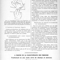 0821 - Page 802 - Partie scientifique. Travaux Originaux. Diététique infantile. Le redressement méthodique du pied bot congénital, par Mutel et G. Roedere. Technique des manoeuvres / Leredressement doit aller jusqu'à l’hypercorrection / Les séances de redressement / Résistance du pied bot aux manoeuvres de redressement / A propos de la radiothérapie des fibromes. Traitement en une seule série de champs (2 séances), par le Dr. Guilbert