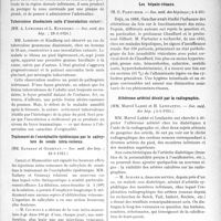 1827 - Page 1775 - Partie scientifique. L’Actualité Scientifique. Les Sociétés Savantes. Paris. Accidents dans la radiothérapie de la région dorsale inférieure, (Académie de médecine ; 17-6-1924) / Tuberculose disséminée suite d’inoculation cutanée, (Soc. méd. des hôp. ; 28-3-1924) / Traitement de l’encéphalite épidémique par le salicylate de soude intra-veineux, (Soc. méd. des hôp. ; 28-3-1924) / Endocardite blennorrhagique guérie par sérothérapie, (Soc. méd. des hôpitaux ; 21--3-1924) / Les hépato-rénaux, (Soc. méd. des hôpitaux ; 4-4-26) / Athérome artériel décelé par la radiographie, (Soc. méd, des hôp. ; 4-4-1924) / Rétrécissement congénital du duodénum, (Société de pédiatrie ; 19-2-1924)