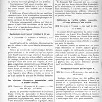 1940 - Page 1886 - Partie scientifique. L’Actualité Scientifique. Les Sociétés Savantes. Paris. Innervation sensitive de la région sous-glottique, (Académie de médecine ; 1-7-19. 24) / Gastrectomie pour cancer remontant à 24 ans, (Académie de médecine ; 1-7-1924) / Les injections d’hypophyse peuvent-elles guérir le diabète insipide, (Soc. méd. deshôp. ; 11-4-1924) / Les injections intra-veineuses d’émétine, (Soc. méd. des hôp. ; 2-5-1924) / Oblitération de l’artère axillaire consécutive à l’usage prolongé d’une béquille, (Soc. méd. des hôp. ; 11-4-1924) / Syringomyélie traitée par les rayons X, (Soc. méd. des hôp. ; 11-4-1924) / Vaccination anti-diphtérique par l’anatoxine, (Soc. méd. des hôp. ; 9-5-1924)