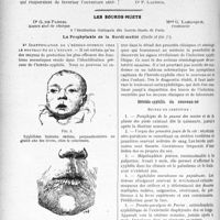 2894 - Page 2828 - Partie Scientifique. Travaux Originaux. Clinique dermatologique. Le zona. (Zona et varicelle), M. le Pr Jeanselme / Les sourds muets, Dr G. de Parrel, Mme G. Lamarque. La Prophylaxie de la Surdi-mutité (Suite et fin). Heredo-syphilis du nouveau-né
