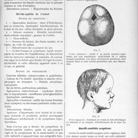 2895 - Page 2829 - Partie Scientifique. Travaux Originaux. Clinique dermatologique. Les sourds muets, Dr G. de Parrel, Mme G. Lamarque. La Prophylaxie de la Surdi-mutité (Suite et fin). Heredo-syphilis du nouveau-né / Hérédo-syphilis de l’enfant / Surdi-mutités acquises