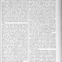 3071 - Page 2995 - Partie scientifique. Travaux Originaux. Clinique obstétricale. Le placenta praevia, d’après une leçon du professeur Jeannin