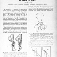 0944 - Page 801 - Partie scientifique. Travaux Originaux. « Ostéochondrite » = subluxation congénitale méconnue» le dernier cas objecté, par F. Calot