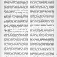 0949 - Page 806 - Partie scientifique. Travaux Originaux. Clinique chirurgicale. Les luxations sterno-claviculaires, M. J. P. Tourneux