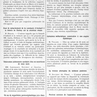1346 - Page 1129 - Partie scientifique. L'Actualité Scientifique. Les Sociétés Savantes. Montpellier. Société des Sciences médicales et biologiques de Mont-pellier et du Languedoc méditerranéen. Greffes à lambeau tubulé / Abcès du foie / Essai de rattachement de la constante d’Ambard à la théorie de Cushny sur la sécrétion rénale / Tuberculose pulmonaire cavitaire chez un nourrisson de onze mois / Un cas de myasthénie posteneéphalitique avec ébauche d’un synDr. ome adiposo-génital / Ophtalmie métastatique consécutive à une angine diphtérique / La trousse photogène du médecin praticien / Position curieuse de l’appendice vermiculaire