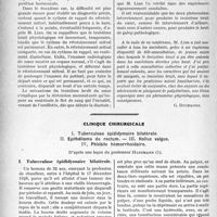 1407 - Page 1182 - Partie scientifique. Travaux Originaux. Cardiologie. Le troisième bruit du coeur, d’après une conférence de M. C. Lian / Clinique chirurgicale, d’après une leçon du professeur Hartmann