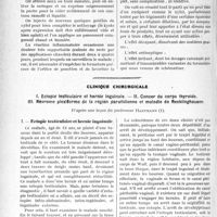 1759 - Page 1496 - Partie scientifique. Travaux Originaux. Le xylol en dermatologie, par M. Louis Bory / Clinique chirurgicale. Ectopie testiculaire et hernie inguinale. — Cancer du corps thyroïde. — Névrome plexiforme de la région parotidienne et maladie de Recklinghausen, d’après une leçon du professeur Hartmann