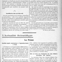 2912 - Page 2629 - Partie scientifique. Travaux Originaux. Note au sujet de l'articulation hermaphrodite des forceps croisés. Insufflation des nouveau-nés [Dr. Roux] / L’Actualité Scientifique. La Presse. Parotidites aiguës consécutives à l’appendicectomie à froid [(Toulouse médical, 1er février 1927)] / Note sur deux cas d’hydropisie des voies biliaires principales (bile blanche)