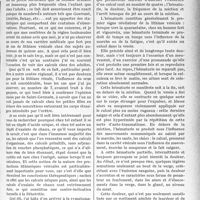 3330 - Page 3039 - Partie scientifique. Travaux Originaux. Clinique chirurgicale. De la lithiase vésicale chez l’enfant, M. J. -P, Tourneux