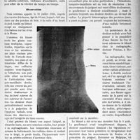3464 - Page 3171 - Partie scientifique. Travaux Originaux. Morphologie clinique. Contribution à l’étude de l’artérite traumatique