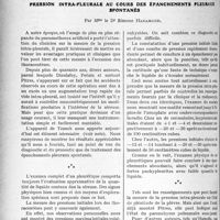 0309 - Page 302 - Partie scientifique. Travaux Originaux. Pression intra-pleurale au cours des épanchements pleuraux spontanés, par Mme le Dr Simone Hadamard