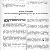 0901 - Page 888 - Partie scientifique. Travaux Originaux. Diagnostic extemporané de l’encéphalite léthargique vraie « (phaséolunatisme) par l’analyse spectrale, par le Dr Albert Veillard / Clinique chirurgicale. Anévrysme artérioso-veineux consécutif à une plaie en séton par balle (région inguinale). Tumeur mixte de la parotide, d’après une leçon du professeur Hartmann