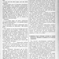 1712 - Page 1693 - Partie scientifique. L’Actualité Scientifique. La Presse. Les abcès pulmonaires au point de vue chirurgical [(Archives méd. chirurg. de l’appareil respiratoire, T. III, n° 5, 1928)] / L’inhalation de gaz carbonique (méthode de Yandell Henderson), stimulant et régulateur de la fonction respiratoire [(La Presse médicale, 10 janvier 1929)]