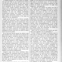 3404 - Page 3309 - Partie scientifique. Travaux Originaux. Clinique chirurgicale. Ulcère syphilitique de jambe, d’après une leçon du professeur Delbet