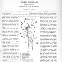 0392 - Page 391 - Partie scientifique. Travaux Originaux. Pancréatite chronique avec ictère et cholecysto-gastrotomie forme anormale de pancréatite chronique, par Maurice Patel / Clinique chirurgicale, Hôpital Cochin. Les fractures du col du fémur, Professeur P. Delbet