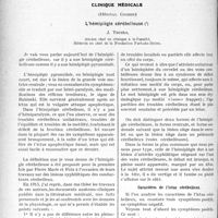 1761 - Page 1754 - Partie scientifique. Travaux Originaux. Les gens en retard, par le Dr Paul Chavigny / Clinique médicale, (Hôpital Cochin). L'hémiplégie cérébelleuse, J. Thiers. Caractères de l’ictus cérébelleux