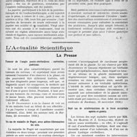 1772 - Page 1765 - Partie scientifique. Travaux Originaux. La clinique au goût du jour. Le traitement des ulcères de l’estomac, d’après les travaux du Dr H. Mondor, ceux du Dr Gaston Lyon et du Dr de Butler d’Ormond. C'est au contraire le traitement médical, qui est indiqué pour l’ulcère non perforé, non calleux. Ulcère à la période d’état / L'Actualité Scientifique. La Presse. Tumeur de l’angle ponto-cérébelleux ; opération, guérison [(Gaz. hebd. des sciences méd. de Bordeaux, 23 novembre 1930.)] / Un cas de maladie de Paget, avec adéno-fibromatose du sein [(Gaz. hebd. des sciences médicales de Bordeaux, 16 novembre 1930.)] / Sept cas de néoformations de la fosse occipitale opérés et guéris [(Revue neurologique, novembre 1930.)]
