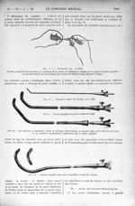 Fig. 7. - Manoeuvre du mandrin / Fig. 8. - Mandrin coudé de Guyon, avec cône / Fig. 9. - Sonde béqui [...]