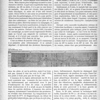 0839 - Page 838 - Partie scientifique. Travaux originaux. Clinique ophtalmologique, Hôtel-Dieu. Péritonite tuberculeuse et pleurésie guéries par le sérum du Professeur A. Jousset