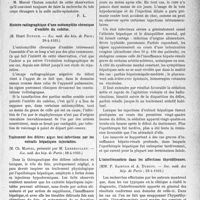 2962 - Page 2921 - Partie scientifique. L’actualité scientifique. Les Société Savantes. Paris. Corps étranger (barrette) de la 4eportion du duodénum chez une enfant de deux ans, (Société de chirurgie ; 28-6-1933) / Histoire radiographique d’une ostéomyélite chronique d’emblée du cubitus, (Soc. méd. des hôp. de Paris ; 28-4-1933) / Traitement des délires aigus toxi-infectieux par les extraits hépatiques injectables, (Soc. méd. des hôp. du Paris ; 28-4-1933) / L’interférométrie dans les affections thyroïdiennes, (Soc. méd. des hôp. de Paris ; 28-4-1933)