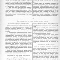 3533 - Page 3492 - Partie scientifique. Travaux originaux. La clinique génito-urinaire au goût du jour. Le toucher rectal, clef du diagnostic dans les affections de la prostate, d’après le Docteur G. Bouzom. Pour bien pratiquer un toucher rectal / Les indications fournies par le toucher rectal