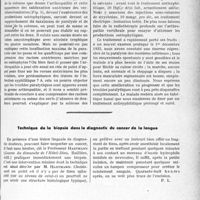 3664 - Page 3623 - Partie scientifique. Travaux originaux. A propos d’une observation de tabes arthropathique avec poliomyélite antérieure chronique, par Georges Boudin / Technique de la biopsie dans le diagnostic du cancer de la langue