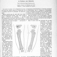 0244 - Page 227 - Partie scientifique. Travaux originaux. Introduction à la vie de médecin de campagne. Dix-huitième lettre. Infractions ou Fractures sans dislocation, par le Docteur Jean Camescasse