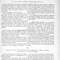0250 - Page 233 - Partie scientifique. Travaux originaux. Introduction à la vie de médecin de campagne. Pour la physiologie de la danse acrobatique. L’énigme du grand écart, d’après MM. H. Meige et P. Bellugue. Le grand écart de côté. Le grand écart de face / Malgré l’illusion d’une dislocation coxo-fémorale, la tête du fémur ne quitte pas la cavité cotyloïde