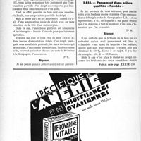 1527 - Page 1304-X - Correspondance. Application du tarif des accidents du travail. Amputation de doigt / Pansement d’une brûlure qualifiée « flambée »