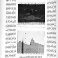 1543 - Page 1320 - Partie scientifique. Travaux originaux. Pression intra-artérielle et pression moyenne, par le Docteur René Giroux. Pression intra-artérielle / Pression moyenne