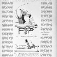 1956 - Page 1665 - Partie scientifique. Travaux originaux. Traitement orthopédique des fractures diaphysaires fermées de jambe, par le Docteur F. Masmonteil. Réduction. Préparation du blessé / Contention