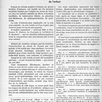 2221 - Page 1886 - Partie scientifique. L'actualité scientifique. Thérapeutique. Pleurésies séro-fibrineuses, splénopneumonies, fièvres d'invasion tuberculeuse de l'enfant