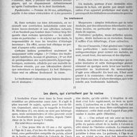 3329 - Page 2900 - Partie scientifique. Travaux originaux. La clinique stomatologique au goût du jour. Dents et Peau. L'observation clinique / Le traitement / Les dents, qui s'arrachent par la narine [G. Fischer]