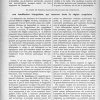 0219 - Page 218 - Partie scientifique. Travaux originaux. Au chevet des blessés. Pour la réduction des fractures avec déplacement, la traction par adhésifs n’est pas de tout repos / Le signe de Comolli dans les fractures de l’omoplate, une tuméfaction triangulaire, qui recouvre toute la région scapulaire [G. Fischer]