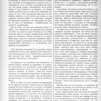 0283 - Page 282 - Partie scientifique. Travaux originaux. Au chevet des patients. Une crise de colique néphrétique ?... non ; mus le début d’une tuberculose urinaire [G. Fischer]