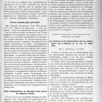 0790 - Page 791 - Partie scientifique. L’actualité scientifique. Les Sociétés Savantes. Paris. Société médico-chirurgicale des hôpitaux libres, Séance du 4 décembre 1936. Deux cas d’ulcération rectale après curiethérapie d’un cancer du col de l’utérus (radio-nécrose) / Leucose tumorale aiguë particulière / Étapes radio graphiques de régression d’une tumeur du médiastin irradiée / Mort par argyrie aiguë après urétrographie (avec quelques considérations sur le danger de cette exploration) / Société d’hydrologie et de climatologie médicales de Paris. Les variations de la cholestérolémie chez les asthmatiques sous l’influence de la cure du Mont- Dore, (1-3-1937)