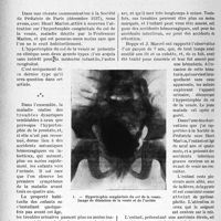 0873 - Page 928 - Partie scientifique. Travaux originaux. L’hypertrophie congénitale du col de la vessie, par le Docteur R. Liège