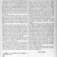 1056 - Page 1043 - Partie scientifique. Travaux originaux. Les méthodes de détermination du début de la coagulation du sang, par R. Martinet