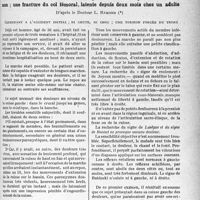 1306 - Page 1293 - Partie scientifique. Travaux originaux. La clinique au goût du jour. Des douleurs rurales et sclatiques avec marche possible ? non ; une fracture du col fémoral, latente depuis deux mois chez un adulte, d’après le Docteur L. Ramond. Cependant à l’accident initial ; ni chute, ni choc ; une torsion forcée du tronc