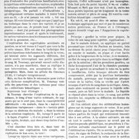 1552 - Page 1539 - Partie scientifique. Les " collections hématiques intra-variqueuses " peuvent et doivent être évitées, par le Docteur Léon Filderman