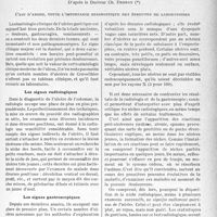 1674 - Page 1661 - Partie scientifique. Travaux originaux. Ce que pratiquement le médecin doit savoir... Des acquisitions récentes sur l'ulcère de l’estomac, D’après le Docteur Ch. Debray. C’est d’abord, toute l’importance diagnostique des épreuves de laboratoires