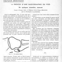 2422 - Page 2285 - Partie scientifique. Travaux originaux. A propos d’une radiographie du pied. De quelques anomalies osseuses, Leçon clinique faite à l’Hôpital Notre-Dame (Montréal) par le Professeur Laquerrière