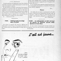 0258 - Page LXV-255 - Correspondance. Application du tarif des accidents du travail. Demande de reçu avant paiement (suite) / Radiographie de doigt face et profil / Le radiographie ne doit envoyer au patron ou assureur qu’une seule épreuve et non deux