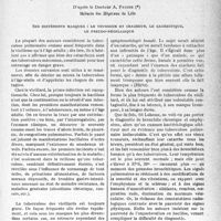 0464 - Page 451 - Partie scientifique. Travaux originaux. La clinique phtisiologique au goût du jour. Quelques caractéristiques de la tuberculose chez les vieillards, d’après le Docteur A. Patoir [G. Fischer]. Ses différents masques : le tousseur et cracheur, le cachectique, le pseudo-néoplasique
