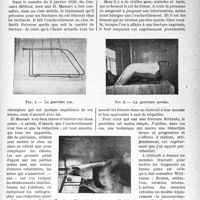 0988 - Page 953 - Partie scientifique. Travaux originaux. Plaies et ruptures traumatiques du tympan, par le Docteur E. Feldstein. Histoire de deux jumeaux univitellins. Ressemblances et dissemblances / Traitement propre à certaines fractures du col fémoral chez le vieillard, George Pascalis
