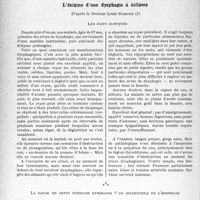 1049 - Page 1014 - Partie scientifique. Travaux originaux. La clinique au goût du jour. L'énigme d’une dysphagie à éclipses, d’après le Docteur Louis Ramond. Les faits cliniques / La cause de cette curieuse dysphagie ? un diverticule de l’oesophage